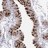 Anti-RSPH4A antibody produced in rabbit Prestige Antibodies® Powered by Atlas Antibodies, affinity isolated antibody, buffered aqueous glycerol solution