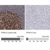 Anti-PCNA antibody produced in rabbit Prestige Antibodies® Powered by Atlas Antibodies, affinity isolated antibody, buffered aqueous glycerol solution, ab2
