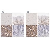 抗ESR1 ウサギ宿主抗体 Ab2, Prestige Antibodies® Powered by Atlas Antibodies, affinity isolated antibody, buffered aqueous glycerol solution