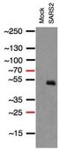 Anti-SARS-CoV-1/2 NP Antibody, clone 1C7C7 ZooMAb® Mouse Monoclonal recombinant, expressed in HEK 293 cells