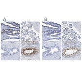 Anti-DNAI1 antibody produced in rabbit Prestige Antibodies® Powered by Atlas Antibodies, affinity isolated antibody, buffered aqueous glycerol solution, Ab1