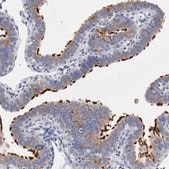 Anti-AK7 antibody produced in rabbit Prestige Antibodies® Powered by Atlas Antibodies, affinity isolated antibody, buffered aqueous glycerol solution