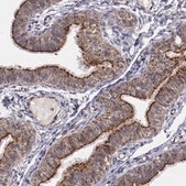 Anti-LONP1 antibody produced in rabbit Ab2, Prestige Antibodies® Powered by Atlas Antibodies, affinity isolated antibody, buffered aqueous glycerol solution