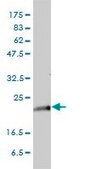 モノクローナル抗KRAS マウス宿主抗体 clone 3B10-2F2, purified immunoglobulin, buffered aqueous solution