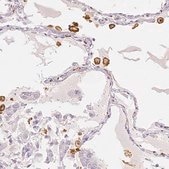Anti-MRC1 antibody produced in rabbit Prestige Antibodies® Powered by Atlas Antibodies, affinity isolated antibody, buffered aqueous glycerol solution