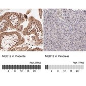 Anti-MED12 antibody produced in rabbit Ab2, Prestige Antibodies® Powered by Atlas Antibodies, affinity isolated antibody, buffered aqueous glycerol solution