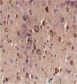 Anti-Tau (4-repeat isoform RD4) Antibody, clone 7D12.1 clone 7D12.1, from mouse