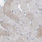 Anti-CUL4B antibody produced in rabbit Prestige Antibodies® Powered by Atlas Antibodies, affinity isolated antibody, buffered aqueous glycerol solution