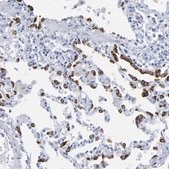 Anti-SFTPC antibody produced in rabbit Prestige Antibodies® Powered by Atlas Antibodies, affinity isolated antibody, buffered aqueous glycerol solution, Ab1
