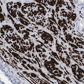 Anti-TAGLN antibody produced in rabbit affinity isolated antibody, buffered aqueous glycerol solution