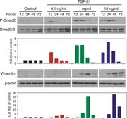 Monoclonal Anti-β-Actin antibody produced in mouse clone AC-15, ascites fluid