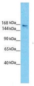 Anti-SLIT3, (N-terminal) antibody produced in rabbit affinity isolated antibody