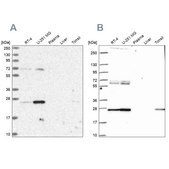 Anti-TFAM antibody produced in rabbit Prestige Antibodies® Powered by Atlas Antibodies, affinity isolated antibody, buffered aqueous glycerol solution