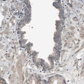 Anti-NRK antibody produced in rabbit Prestige Antibodies® Powered by Atlas Antibodies, affinity isolated antibody, buffered aqueous glycerol solution
