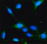 Anti-LAMP2 antibody produced in rabbit affinity isolated antibody, buffered aqueous solution
