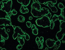 Anti-Cytokeratin, pan antibody, Mouse monoclonal clone PCK-26, purified from hybridoma cell culture