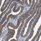 Anti-FIS1 antibody produced in rabbit Prestige Antibodies® Powered by Atlas Antibodies, affinity isolated antibody, buffered aqueous glycerol solution
