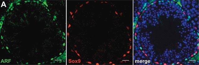 Anti-Sox9 Antibody Chemicon®, from rabbit