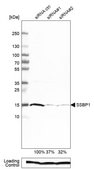 Anti-SSBP1 antibody produced in rabbit Prestige Antibodies® Powered by Atlas Antibodies, affinity isolated antibody, buffered aqueous glycerol solution