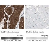 抗CALD1抗体 ウサギ宿主抗体 Ab1, Prestige Antibodies® Powered by Atlas Antibodies, affinity isolated antibody, buffered aqueous glycerol solution