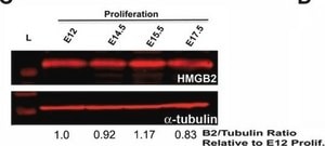 Anti-Tubulin Antibody, beta III isoform, CT, clone TU-20 (Similar to TUJ1) ascites fluid, clone TU-20 (Similar to TUJ1), Chemicon®