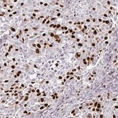 抗ANLN抗体 マウス宿主抗体 Prestige Antibodies® Powered by Atlas Antibodies, clone CL0301, purified immunoglobulin, buffered aqueous glycerol solution