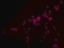 Rhodamine B labeled Polymyxin B Ready Made Solution For fluorescent microbial imaging, 1.1 mg/mL in water