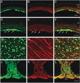 Anti-Neurofilament L Antibody serum, Chemicon®