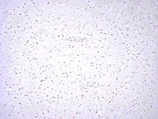 Anti-von Willebrand Factor Antibody Chemicon®, from rabbit