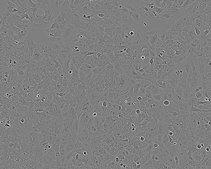 Huh-7D 12 Cell Line human NOTE: Both the cell line and DNA from the cell line may be available for this product. Please choose -1VL or VIAL for cells, or -DNA-5UG for DNA. 01042712, human liver, Epithelial