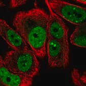 Anti-LRRC41 antibody produced in rabbit Prestige Antibodies® Powered by Atlas Antibodies, affinity isolated antibody, buffered aqueous glycerol solution