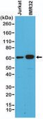 Anti-SMAD4 antibody, Rabbit monoclonal recombinant, expressed in HEK 293 cells, clone RM277, purified immunoglobulin
