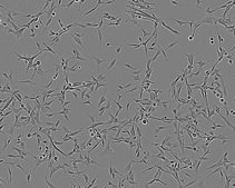 U-87 MG Cell Line human NOTE: Both the cell line and DNA from the cell line may be available for this product. Please choose -1VL or VIAL for cells, or -DNA-5UG for DNA, 89081402, human brain (glioblastoma astrocytoma), Epithelial-like