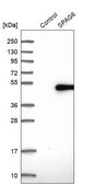 Anti-SPAG6 antibody produced in rabbit Prestige Antibodies® Powered by Atlas Antibodies, affinity isolated antibody, buffered aqueous glycerol solution