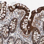 Anti-HOXA5 antibody produced in rabbit Prestige Antibodies® Powered by Atlas Antibodies, affinity isolated antibody, buffered aqueous glycerol solution