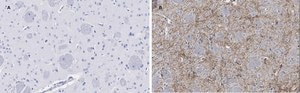 Anti-Tyrosine Hydroxylase Antibody, clone 3M12, ZooMAb® Rabbit Monoclonal recombinant, expressed in HEK 293 cells