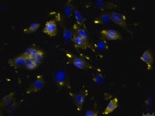 OSUMMER.8 Mouse NRAS-Mutant Melanoma Cell Line