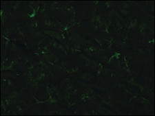 Anti-Glial Fibrillary Acidic Protein antibody, Mouse monoclonal clone G-A-5, purified from hybridoma cell culture