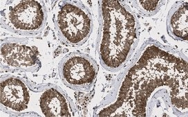 Anti-GAPDH Antibody, clone 10B13, ZooMAb® Rabbit Monoclonal recombinant, expressed in HEK 293 cells