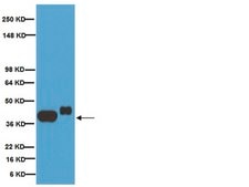 Anti-Synaptophysin Antibody, clone SY38 clone SY38, Chemicon®, from mouse