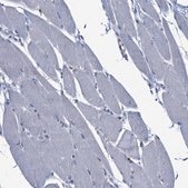 Anti-CCL2 antibody produced in rabbit Prestige Antibodies® Powered by Atlas Antibodies, affinity isolated antibody, buffered aqueous glycerol solution