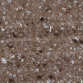 Anti-PTGDS antibody produced in rabbit Prestige Antibodies® Powered by Atlas Antibodies, affinity isolated antibody, buffered aqueous glycerol solution