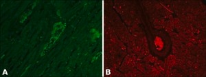 Monoclonal Anti-Vinculin antibody produced in mouse clone hVIN-1, ascites fluid