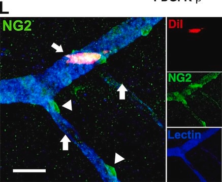 Anti-NG2 Chondroitin Sulfate Proteoglycan Antibody Chemicon®, from rabbit