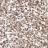 Monoclonal Anti-PIK3CA antibody produced in mouse Prestige Antibodies® Powered by Atlas Antibodies, clone CL8347, purified immunoglobulin, buffered aqueous glycerol solution