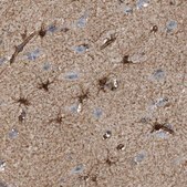 Anti-SEPT2 antibody produced in rabbit Prestige Antibodies® Powered by Atlas Antibodies, affinity isolated antibody, buffered aqueous glycerol solution