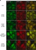 Anti-LC3 antibody produced in rabbit ~1 mg/mL, affinity isolated antibody, buffered aqueous solution
