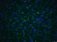 OSUMMER.10 Mouse NRAS-Mutant Melanoma Cell Line
