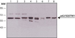 Anti-p62/SQSTM1 antibody produced in rabbit ~1 mg/mL, affinity isolated antibody, buffered aqueous solution