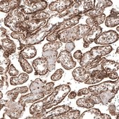 Anti-MB21D1 antibody produced in rabbit Prestige Antibodies® Powered by Atlas Antibodies, affinity isolated antibody, buffered aqueous glycerol solution
